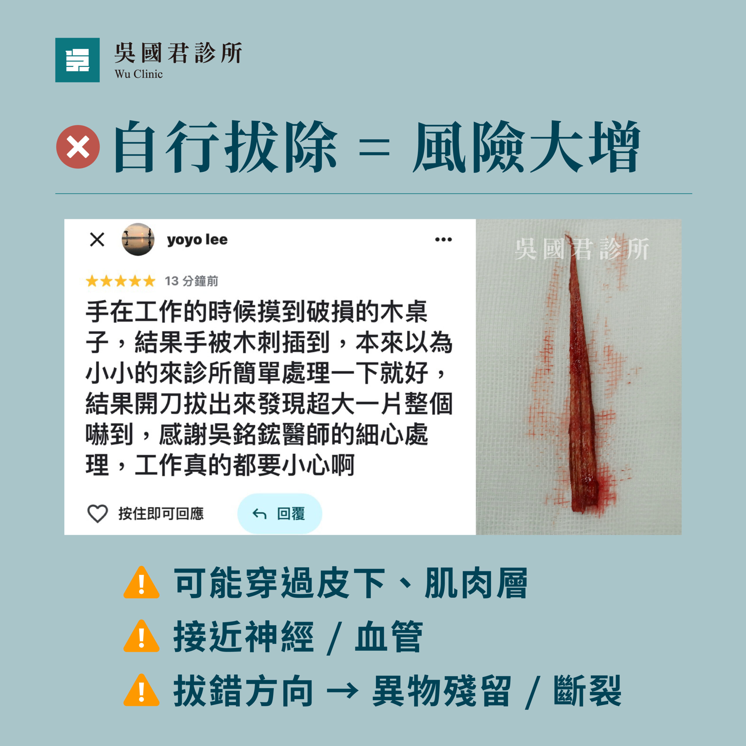 自行拔除的風險